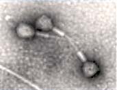 A black and white electron micrograph of bacteriphages that infect salmonellae.